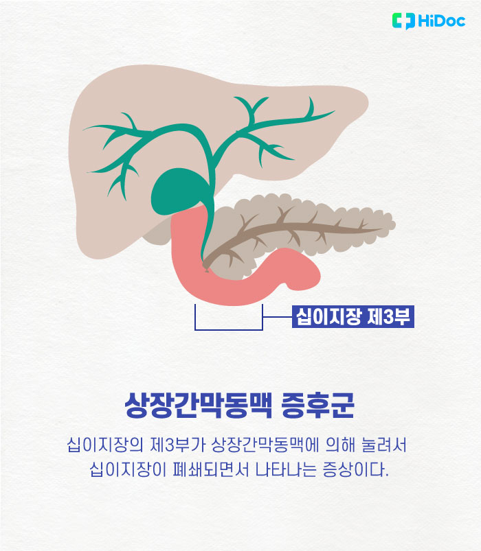 먹기만 하면 극심한 복통, 상장간막동맥 증후군