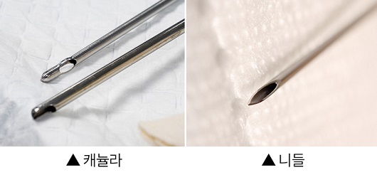 필러시술 시 캐뉼라 vs 니들 차이점”…이마 필러 주의사항은? < 전문가칼럼 < 기사본문 - 하이닥