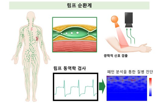유방암 수술 환자의 15~20%에서 발생하는 ‘림프부종’…미리 발견하는 검사법