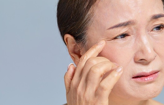 처짐과 주름을 동시에 개선하는 이마거상술, 이마가 넓어지는 것이 걱정된다면 수술 방법을 잘 선택해야 한다 ｜출처: 게티이미지뱅크