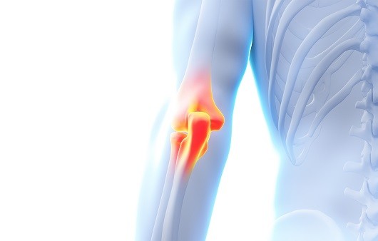테니스, 골프를 즐긴 후 팔꿈치 통증을 겪는 사례가 많다｜출처: 클립아트코리아