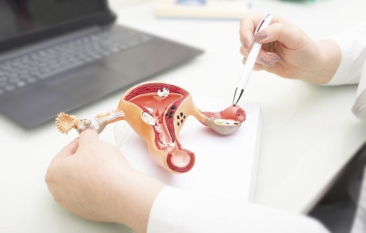 난소암은 자궁경부암에 이어 두 번째로 흔한 부인과 암이다 | 출처: 클립아트코리아