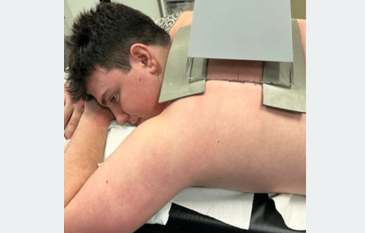 벌레에 물린 줄 알았지만 몇 차례의 검사 끝에 '림프종' 진단을 받은 벤 콜린스 | 출처: The Mirror 캡처