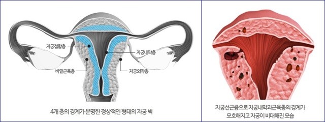 출처: 최상산부인과