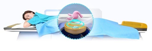 고강도 초음파 집속술 하이푸(HIFU)|출처: 최상산부인과