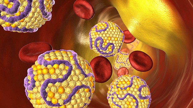 고지혈증은 심혈관질환을 예방하기 위해 꾸준히 치료해야 한다 |출처: 클립아트코리아