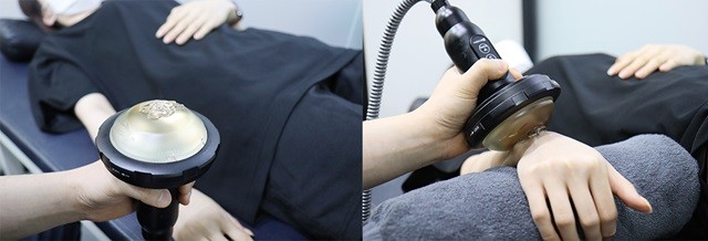 체외충격파 치료｜출처: 원종역마디튼튼의원