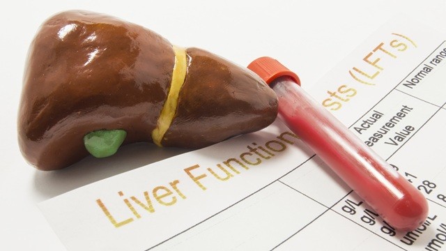 ALT∙AST 수치만으로 간질환 여부를 파악하기는 어렵다|출처: 게티이미지뱅크