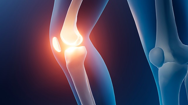 무릎 관절염은 삶의 질을 크게 저하시킬 수 있다 | 출처: 클립아트코리아