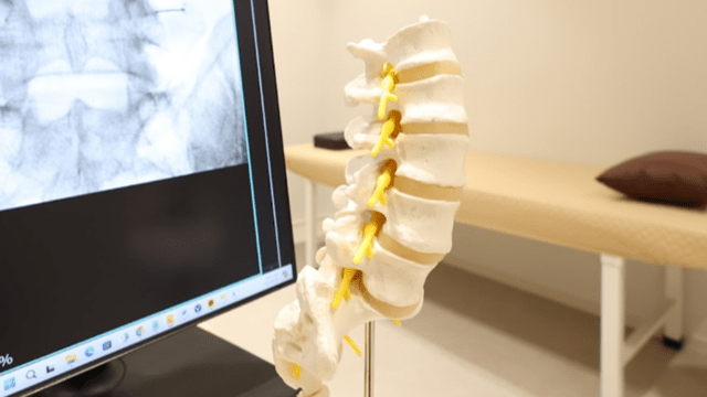 척추가 신경을 눌러 통증과 저림을 유발할 수 있다｜출처: 문광욱 원장