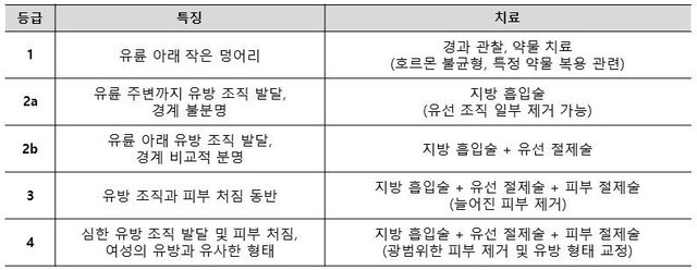 ﻿여성형 유방증 단계별 특징 및 치료법