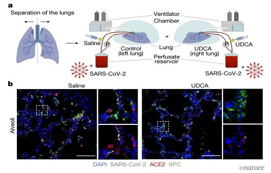 ﻿UDCA는 ACE2 수용체의 문을 닫아 감염을 차단한다ㅣ출처: Nature
