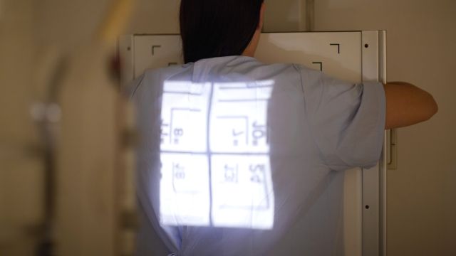 단순 흉부 엑스레이로는 폐암을 선별하기 어려울 수 있다 ｜출처: 클립아트코리아