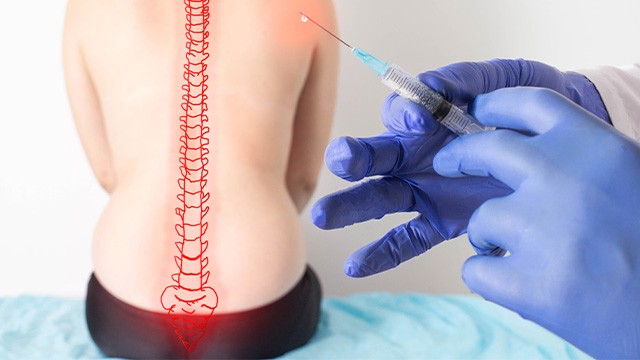 ﻿자율신경 주사 치료는 불편한 부위를 지배하는 자율신경의 경로에 직접 주사를 놓는 치료법이다｜출처: 게티이미지뱅크