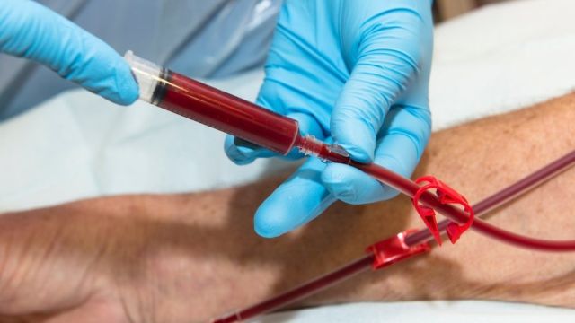 투석혈관시술이 필요한 시점을 정확히 판단하는 것이 가장 중요하다 | 출처: 클립아트코리아