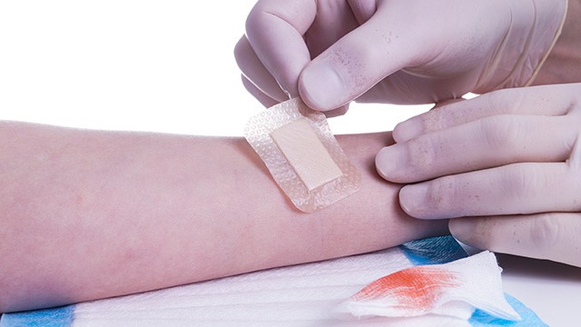 상처가 난 직후 초기 대응만 잘해도 흉터를 최소화할 수 있다|출처: 클립아트코리아