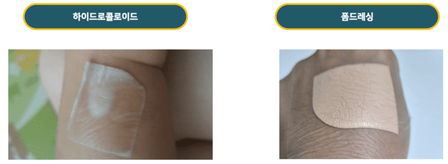 대표적인 습윤 드레싱으로는 하이드로콜로이드형과 폼형이 있다 | 출처: 하이닥