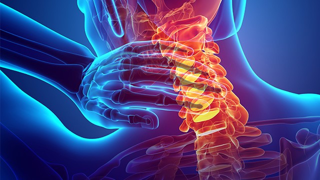 ﻿목디스크 재발을 예방하기 위해서는 관리가 무엇보다 중요하다｜출처: 게티이미지뱅크