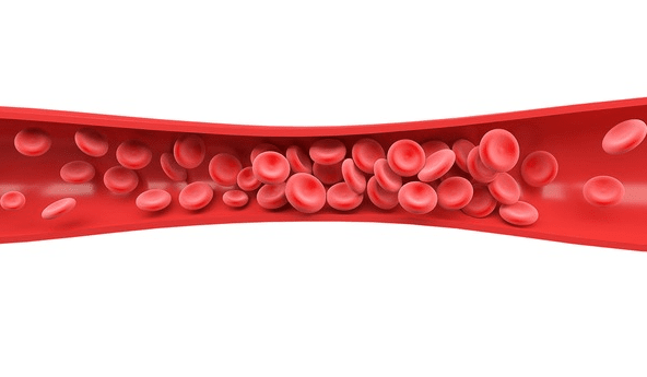 출처: 원더풀의원