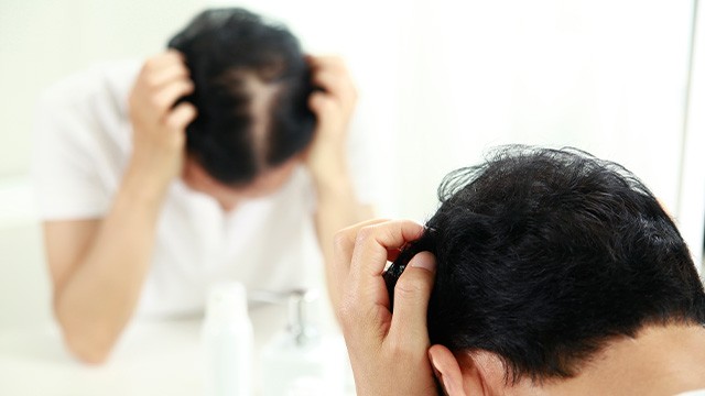 ﻿여름철에 두피를 잘 관리해야 가을철 탈모를 막을 수 있다｜출처: 클립아트코리아