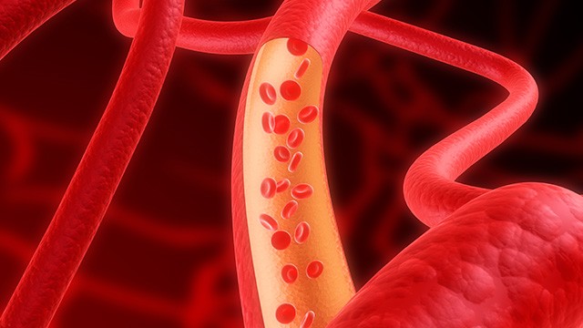 고혈당이 지속되면 심혈관 질환 등의 합병증 위험이 높아진다｜출처: 클립아트코리아