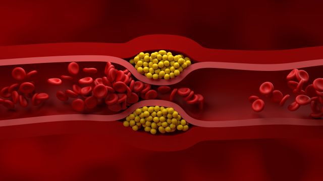 갑작스러운 가슴 통증은 심혈관 질문 문제일 수 있으니 응급실을 찾아야 한다 | 출처: 클립아트코리아