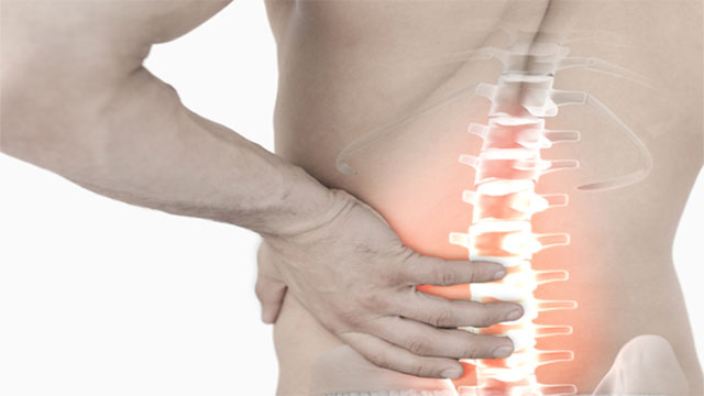 척추관협착증|출처: 클립아트코리아