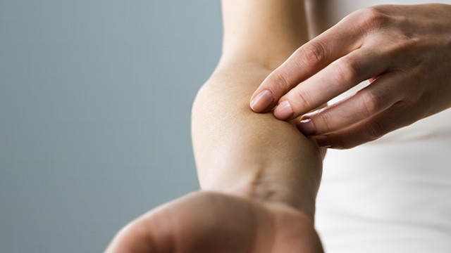 ﻿건선 환자는 염증 유발 식품을 피하는 것이 중요하다｜출처: 게티이미지뱅크