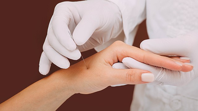 항암제로 인한 말초신경병증에 침과 한약 치료가 도움이 될 수 있다┃출처: 게티이미지뱅크