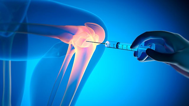 스테로이드 뼈 주사는 근골격계 질환 완화에 효과적이다｜출처: 게티이미지뱅크