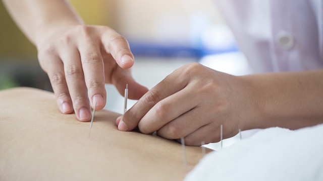 한방 치료는 수술 후 무너진 전신 균형 회복에 도움이 된다┃출처: 게티이미지뱅크