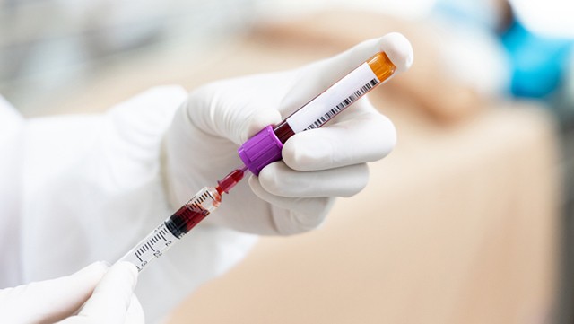 혈소판이 혈액 1㎕ 당 1만 개 이하로 감소하면 뇌출혈 등 심각한 출혈 위험성이 커진다┃출처: 게티이미지뱅크