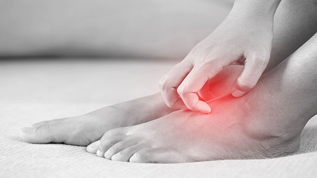 당뇨발 환자라면, 여름철 습진에 주의해야 한다|출처: 게티이미지뱅크