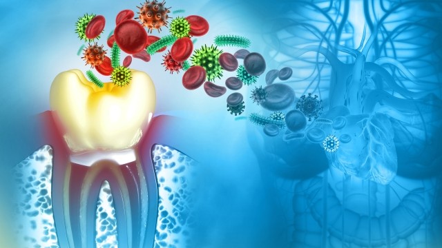구강 내 세균, 곰팡이가 췌장암 발병 위험을 높일 수 있다는 연구 결과가 나왔다|출처: 게티이미지뱅크