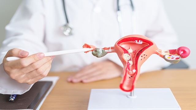 다낭성난소증후군이 있다면 HPV 바이러스에 취약할 수 있다｜출처: 게티이미지뱅크