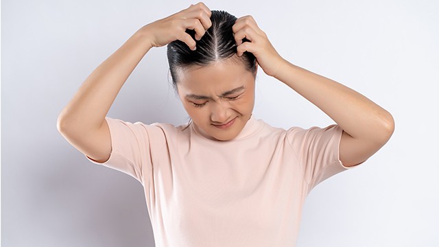 머리 지루성 피부염은 두피에 발생하는 만성 염증성 피부질환이다|출처: 클립아트코리아