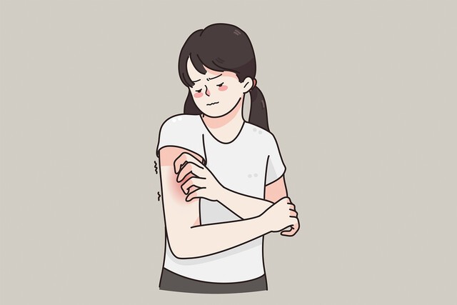 삶의 질 위협하는 만성 피부 질환, 한포진｜출처: 클립아트코리아