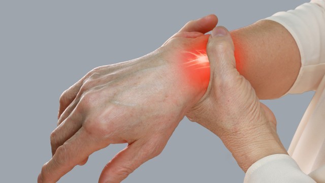 손목건초염을 방치하면 기능저하가 생길 수 있다┃출처: 클립아트코리아