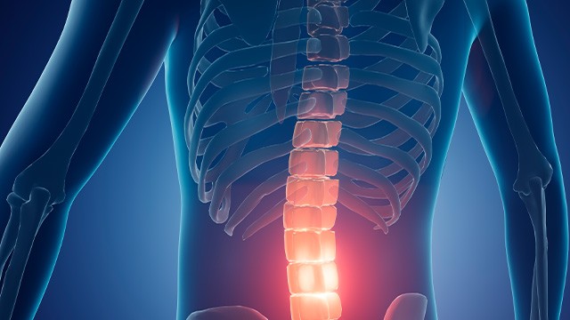 신경차단술은 디스크 탈출증, 척추관 협착증과 같은 만성 통증에 효과적이다｜출처: 클립아트코리아