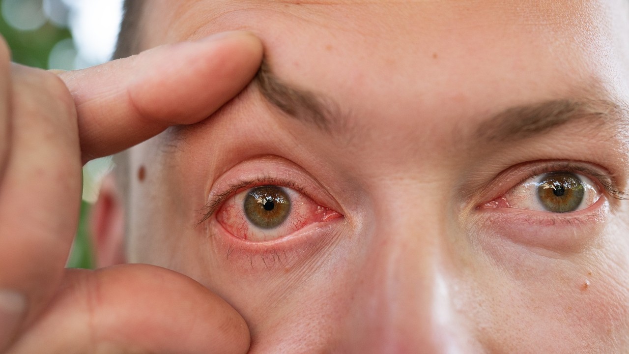 한방에서는 결명자를 결막염 치료에 좋다고 보지만, 임산부나 저혈압 환자는 섭취에 주의가 필요하다｜출처: 클립아트코리아