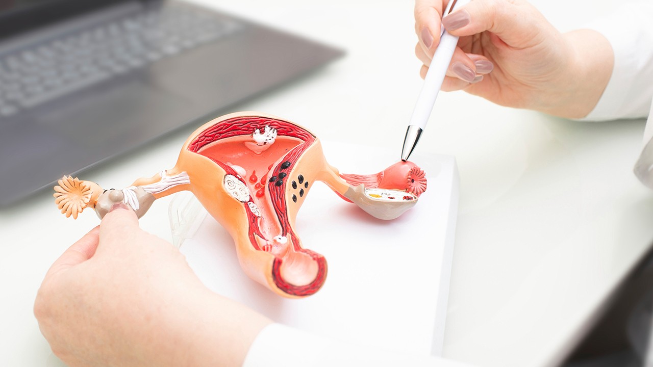 부정출혈은 자궁근종을 포함하여 여러 부인과 질환에서 흔히 동반이 되는 증상이다|출처: 클립아트코리아