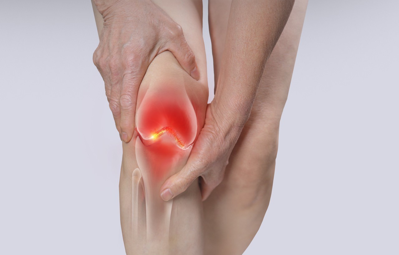 무릎 시큰, 관절 뻣뻣'…방치하면 늦는 퇴행성 관절염, 조기 비수술 치료가 관건｜출처: 클립아트코리아