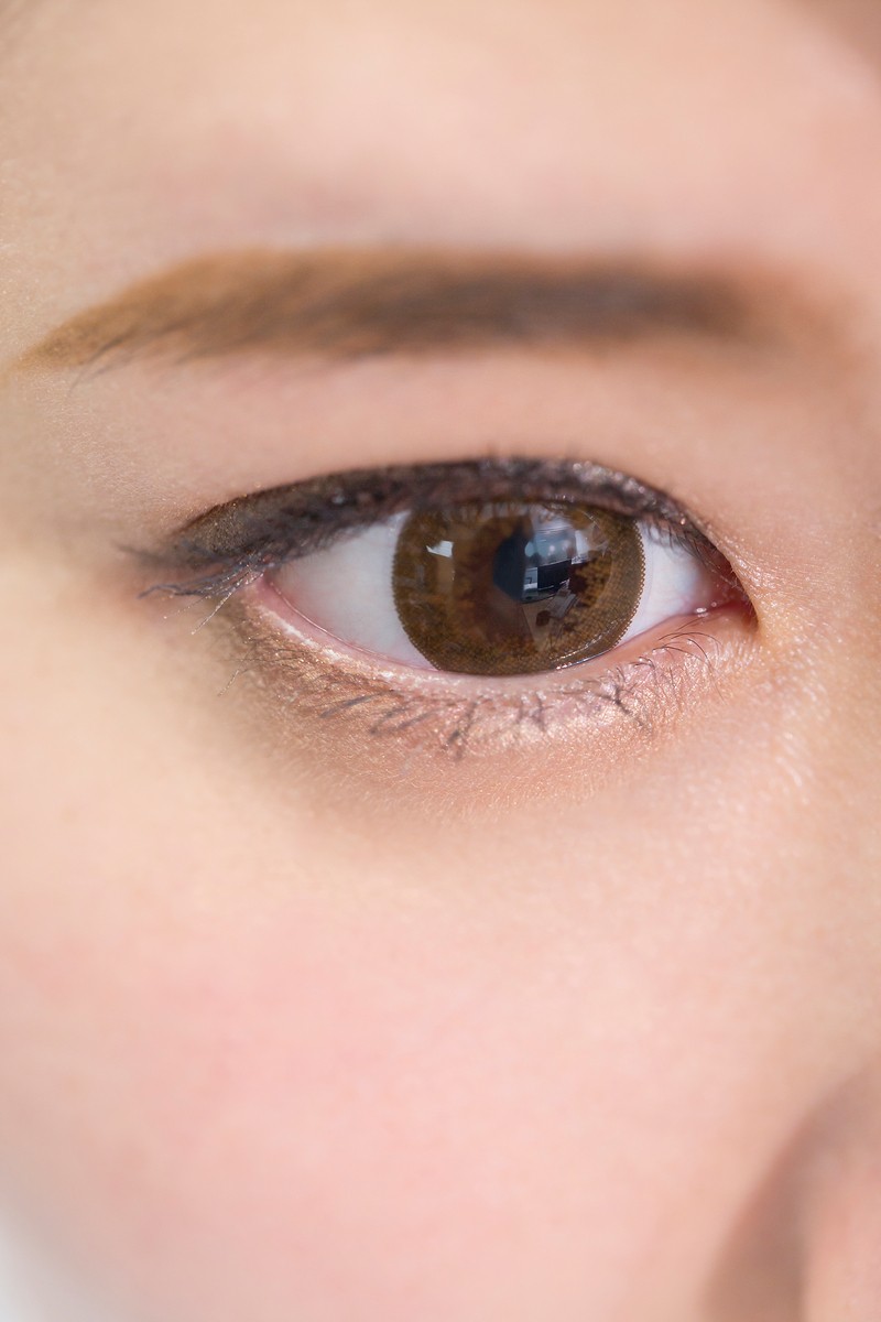 눈 '트임' 수술, 섣부른 자가 판단 금물... "전문의 상담으로 맞춤 수술 찾아야"|출처: 클립아트코리아