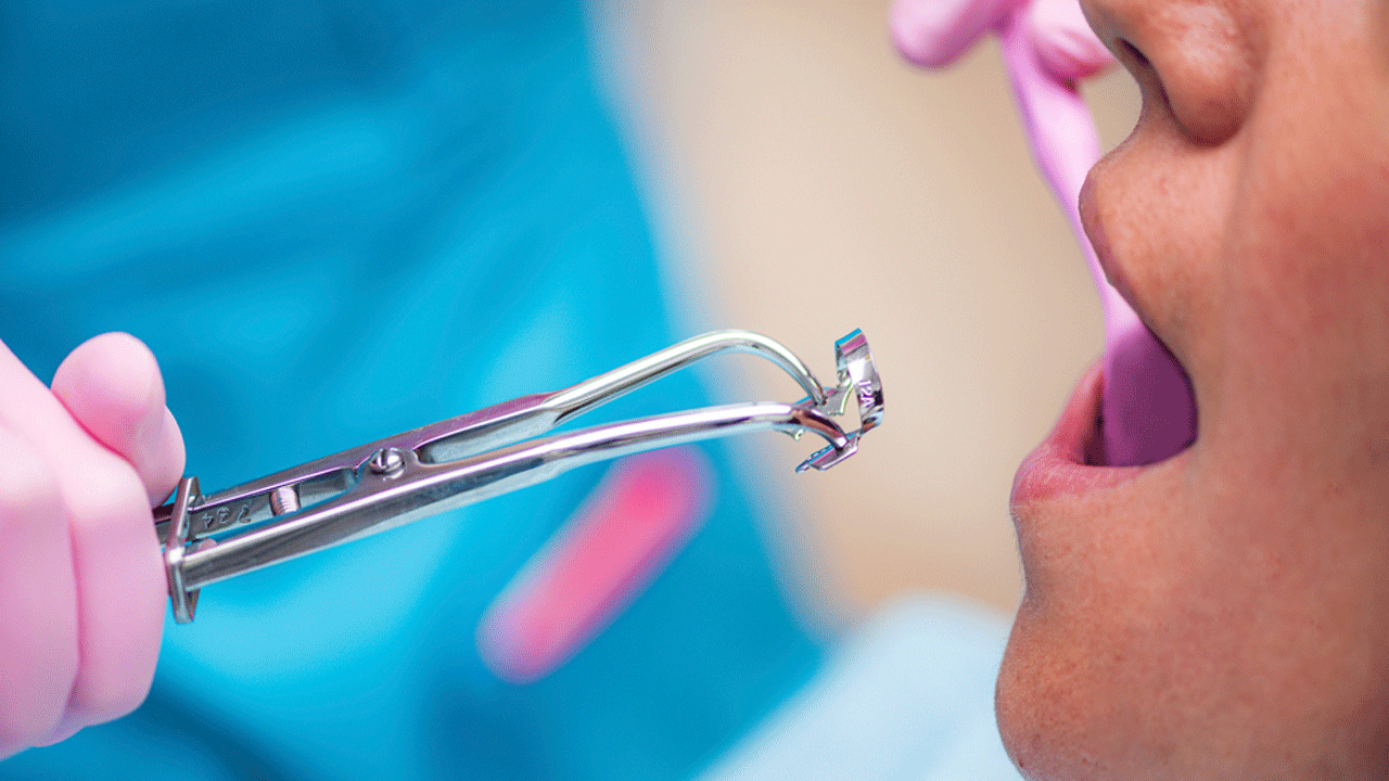 재신경 치료, 높은 난도와 추가 손실 가능성 있어｜출처: 클립아트코리아