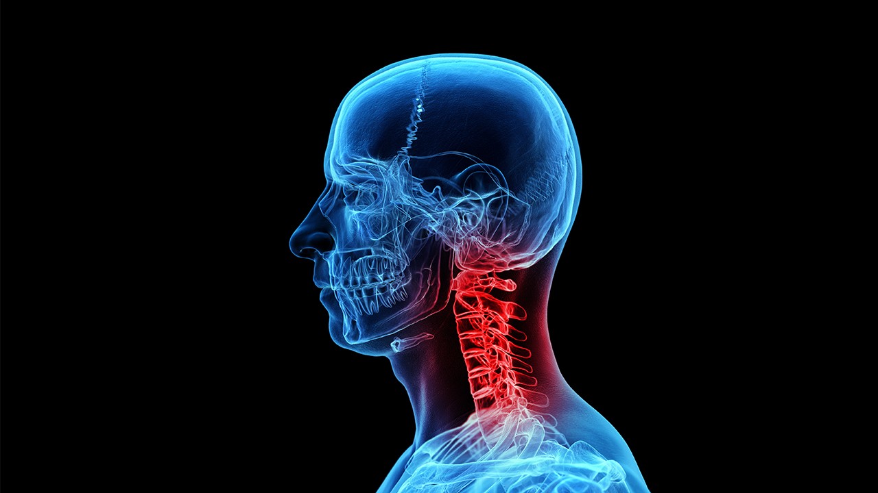 대부분의 목 통증은 수술 없이 호전이 가능하다｜출처: 클립아트코리아