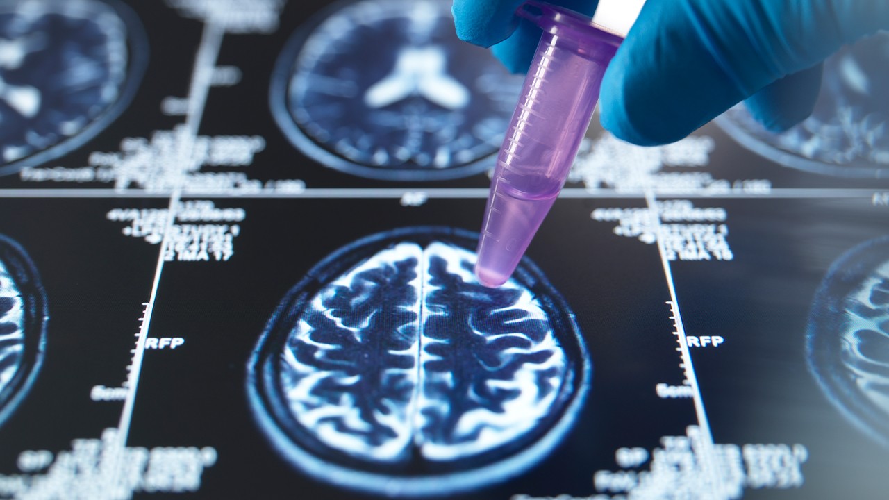 콜린알포세레이트는 뇌 기능과 관련된 인지 기능 개선을 위한 약물이다｜출처: 클립아트코리아