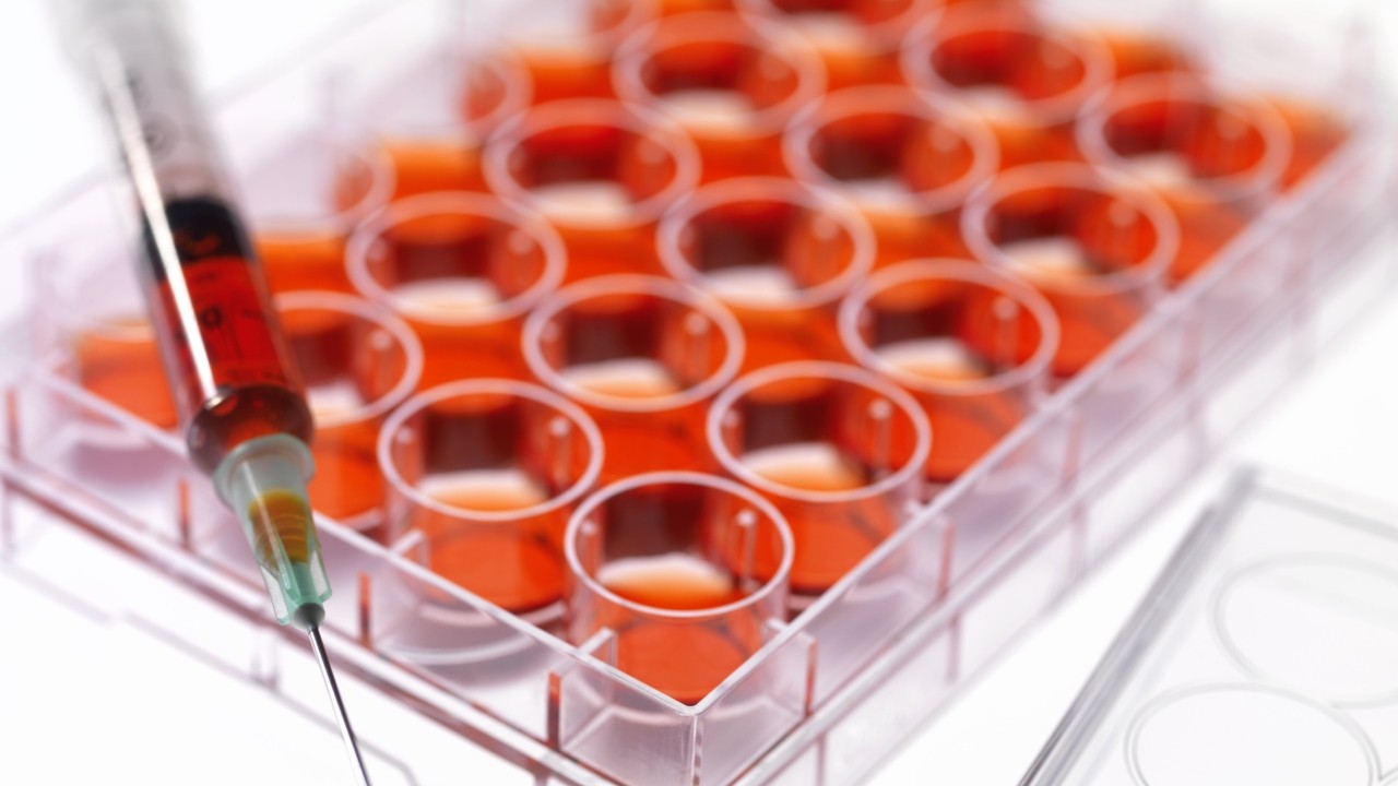 혈액 유래 줄기세포 시술, 항노화, 피로 및 근육통 완화 등에 효과가 있다｜출처: 클립아트코리아