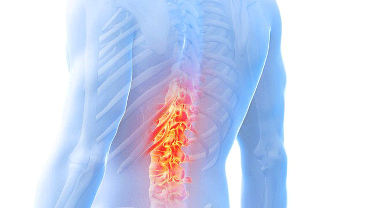 척추관 협착증, 생활 습관 교정으로 관리해야｜출처: 클립아트코리아