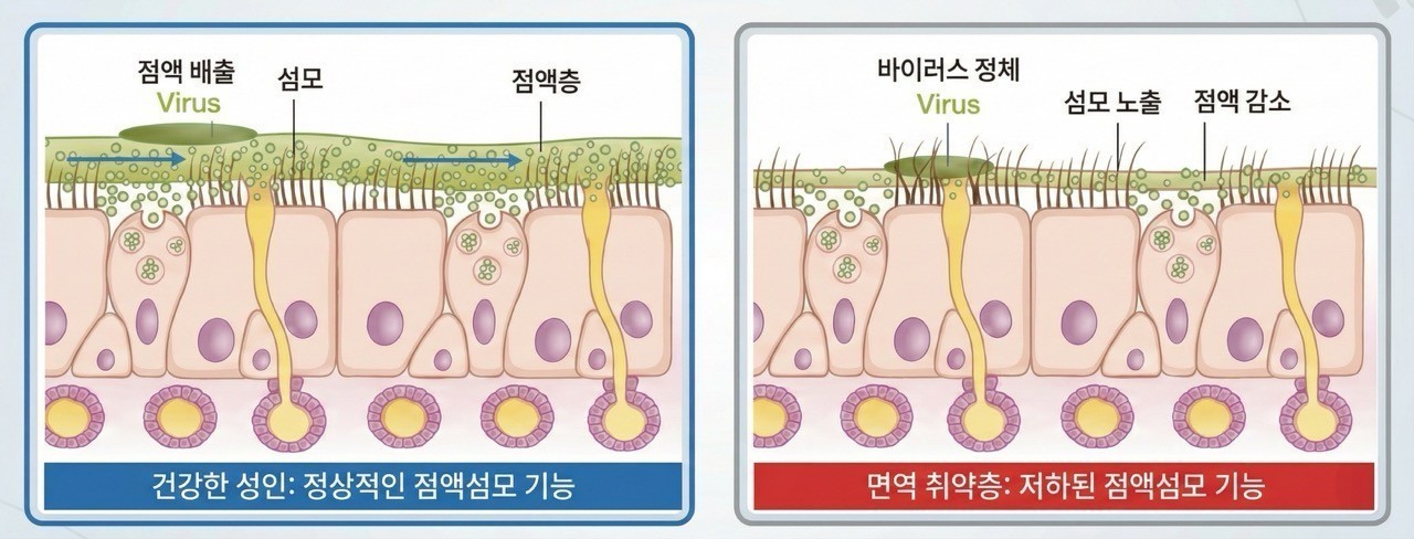 코 점막의 점액·섬모 작용 원리｜출처: 하이닥