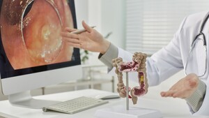 Colonoscopy Intervals After Polyp Removal: 5 Years vs. 3 Years and Colorectal Cancer Risk